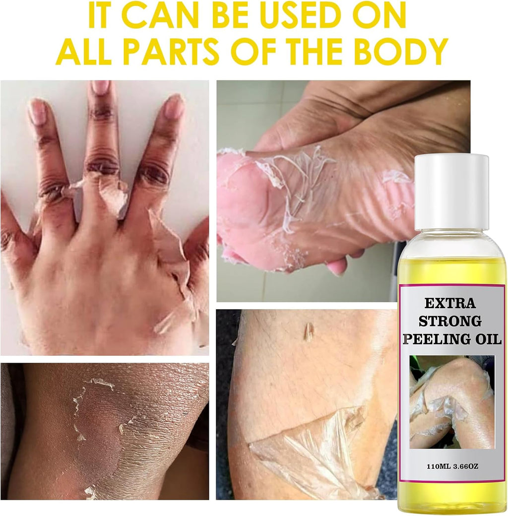 Peeling Oil For Dark Skin, Yellow With Salicylic Sodium Hyaluronate, Strong Extra Strength, Exfoliating Solution Body All Skin Type - 110Ml/3.66 Oz
